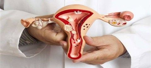 گزارش موردی درمان کیست هموراژیک و پولیپ دهانه رحم در سلامتکده بوعلی