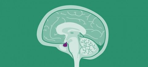 گزارش موردی درمان هایپرپرولاکتینمی